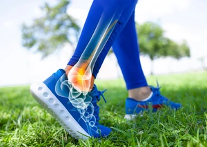 Adobe Stock dragonstock - Fussprobleme beim Sport